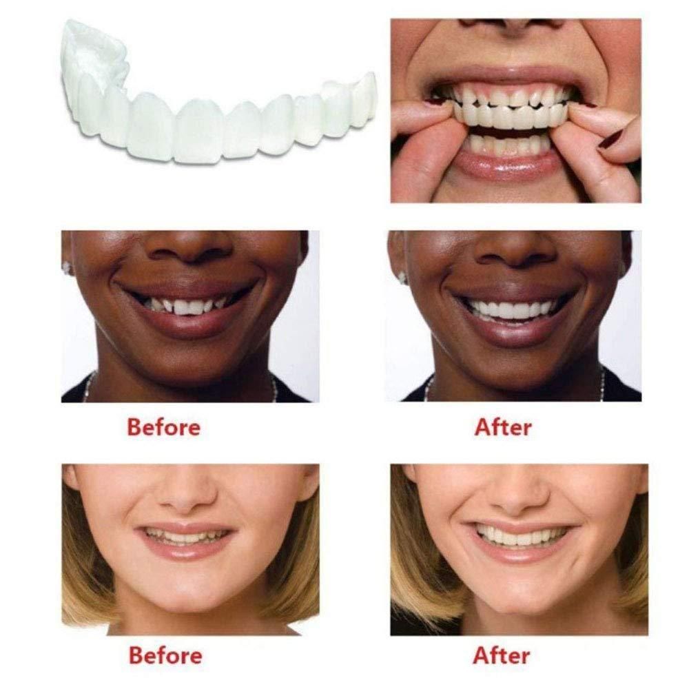 🔥Instant and Confident on Smile Fit Flex Cosmetic Teeth Denture Teeth🔥